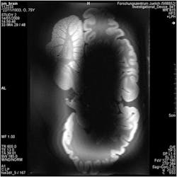 Mwrf Com Sites Mwrf com Files Uploads 2013 06 30 J Fig2 Mwrf Com Sites Mwrf com Files Uploads 2013 06 30 J Fig2