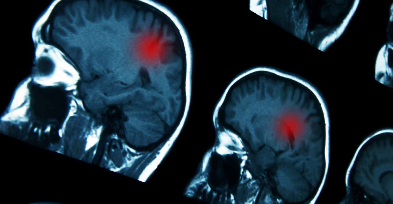 Microwave Ablation Helps Attack Tumors