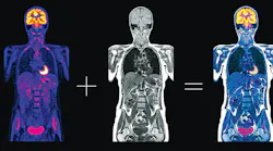 Microwaves May Take on Medical Diagnostics