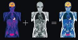 Microwaves May Take on Medical Diagnostics Microwaves May Take on Medical Diagnostics