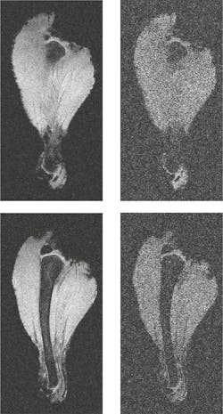 3. MRI scan of a chicken leg. Images acquired 2.25 cm (a, b) and 2.50 cm (c, d), from the top surface of the metamaterial array. Images (a, c) are acquired in the presence of the metamaterial array, while images (b, d) are acquired in the absence of the metamaterial array. All other conditions remained fixed between scans. (Source: Boston University) 3. MRI scan of a chicken leg. Images acquired 2.25 cm (a, b) and 2.50 cm (c, d), from the top surface of the metamaterial array. Images (a, c) are acquired in the presence of the metamaterial array, while images (b, d) are acquired in the absence of the metamaterial array. All other conditions remained fixed between scans. (Source: Boston University)