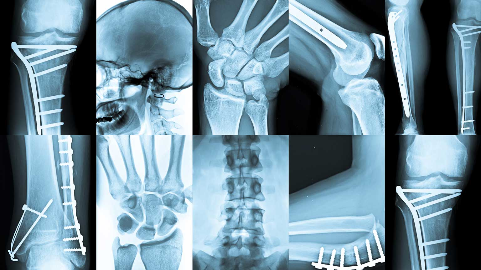 Xray Dreamstime Ultra67 23559314 (1)