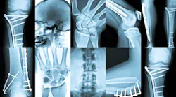 Xray Dreamstime Ultra67 23559314 (1)